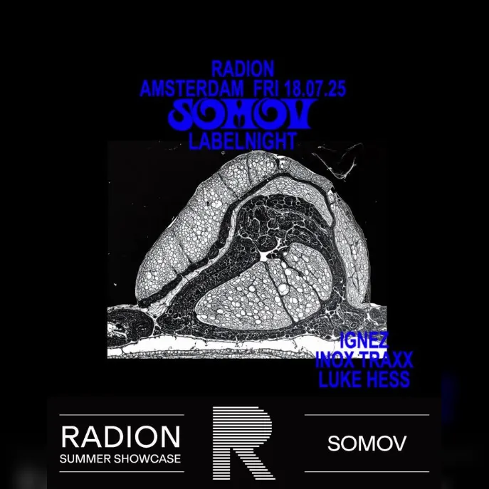 RADION SHOWCASE Somov